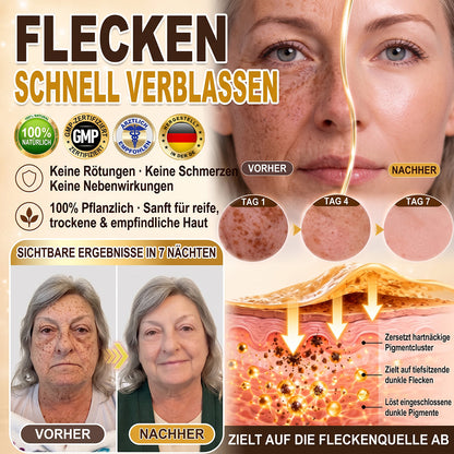 🚨 LETZTES ANGEBOT — Sichern Sie sich unseren niedrigsten Preis aller Zeiten: 90 % RABATT  Eine letzte Chance, 𝗛𝗜𝑺𝑲𝑰𝑵® mit unserem größten Rabattangebot zu sichern — dieses exklusive Angebot verschwindet, sobald Sie diese Seite verlassen.