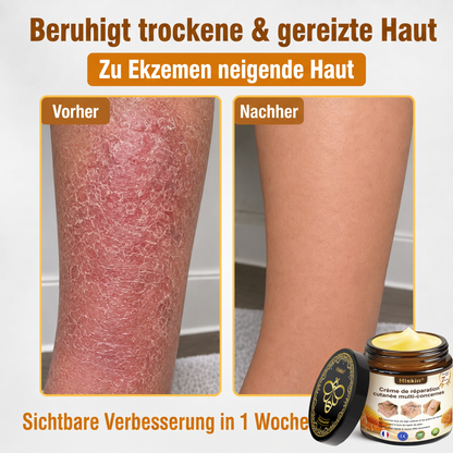 Letzte Chance! Sichern Sie sich diesen Glücksfund mit 90 % Rabatt, um Warzen dauerhaft zu entfernen! 🔥 180-Tage-Geld-zurück-Garantie! Handeln Sie schnell! HISKIN®