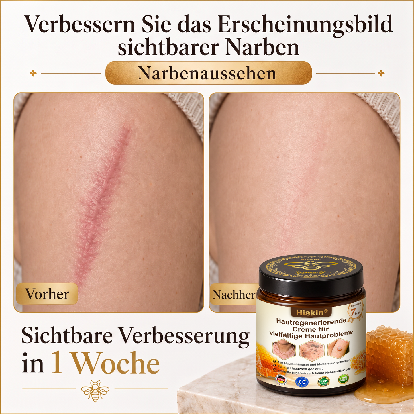 Letzte Chance! Sichern Sie sich diesen Glücksfund mit 90 % Rabatt, um Warzen dauerhaft zu entfernen! 🔥 180-Tage-Geld-zurück-Garantie! Handeln Sie schnell! HISKIN®
