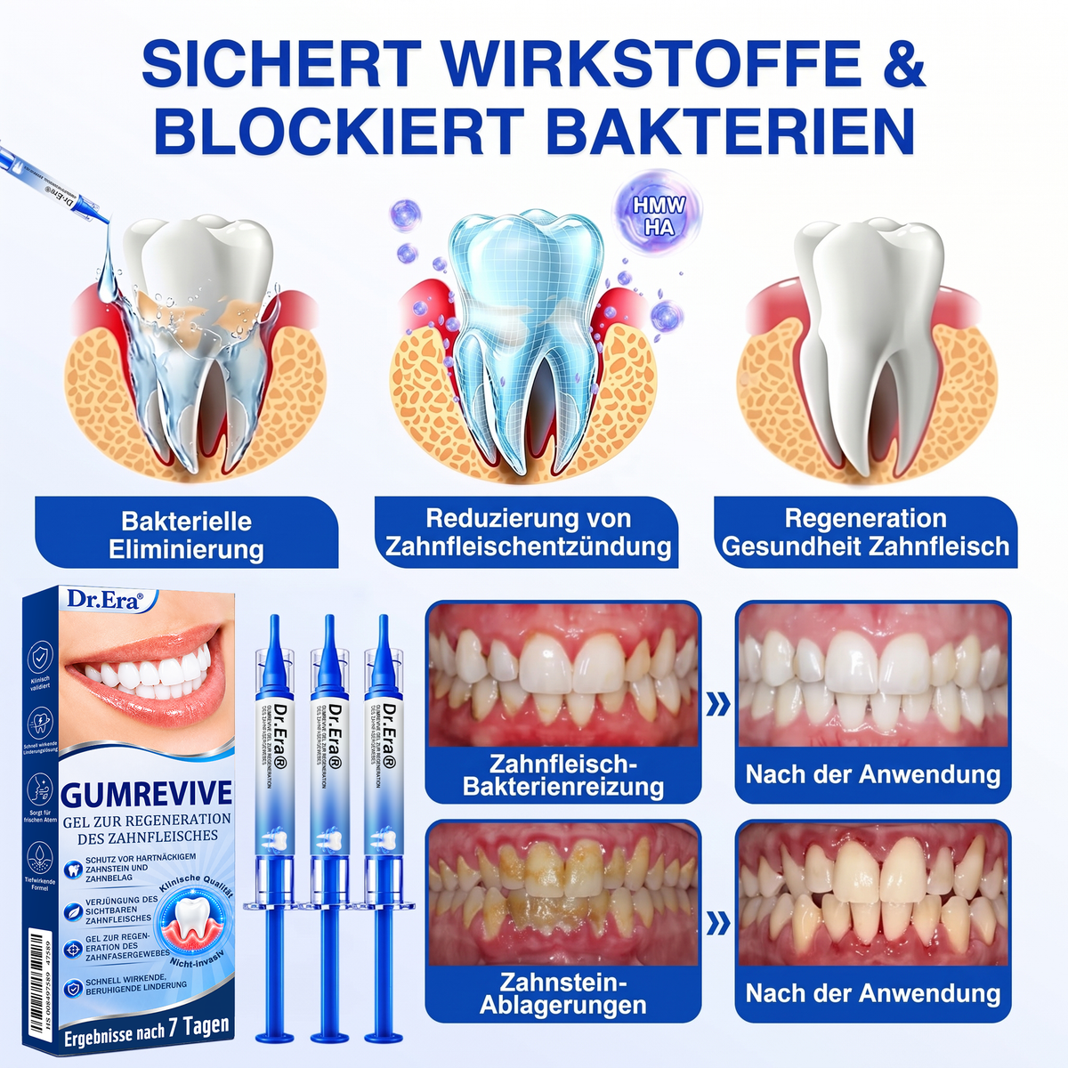 🇩🇪🏆🦷🛡️ Dr. Era® GumRevive — Klinisches Gel: Stoppt Zahnfleischbluten, regeniert Zahnfleisch & festigt Zähne