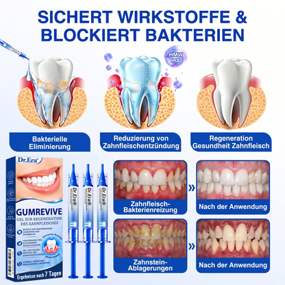 🇩🇪🏆🦷🛡️ Dr. Era® GumRevive — Klinisches Gel: Stoppt Zahnfleischbluten, regeniert Zahnfleisch & festigt Zähne
