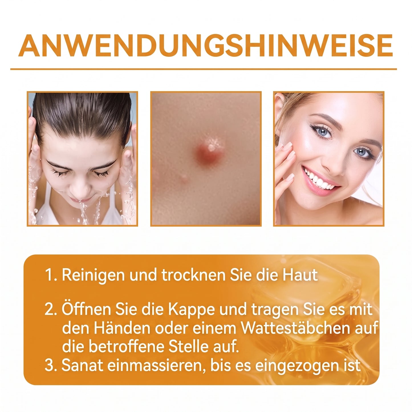 Letzte Chance! Sichern Sie sich diesen Glücksfund mit 90 % Rabatt, um Warzen dauerhaft zu entfernen! 🔥 180-Tage-Geld-zurück-Garantie! Handeln Sie schnell! HISKIN®