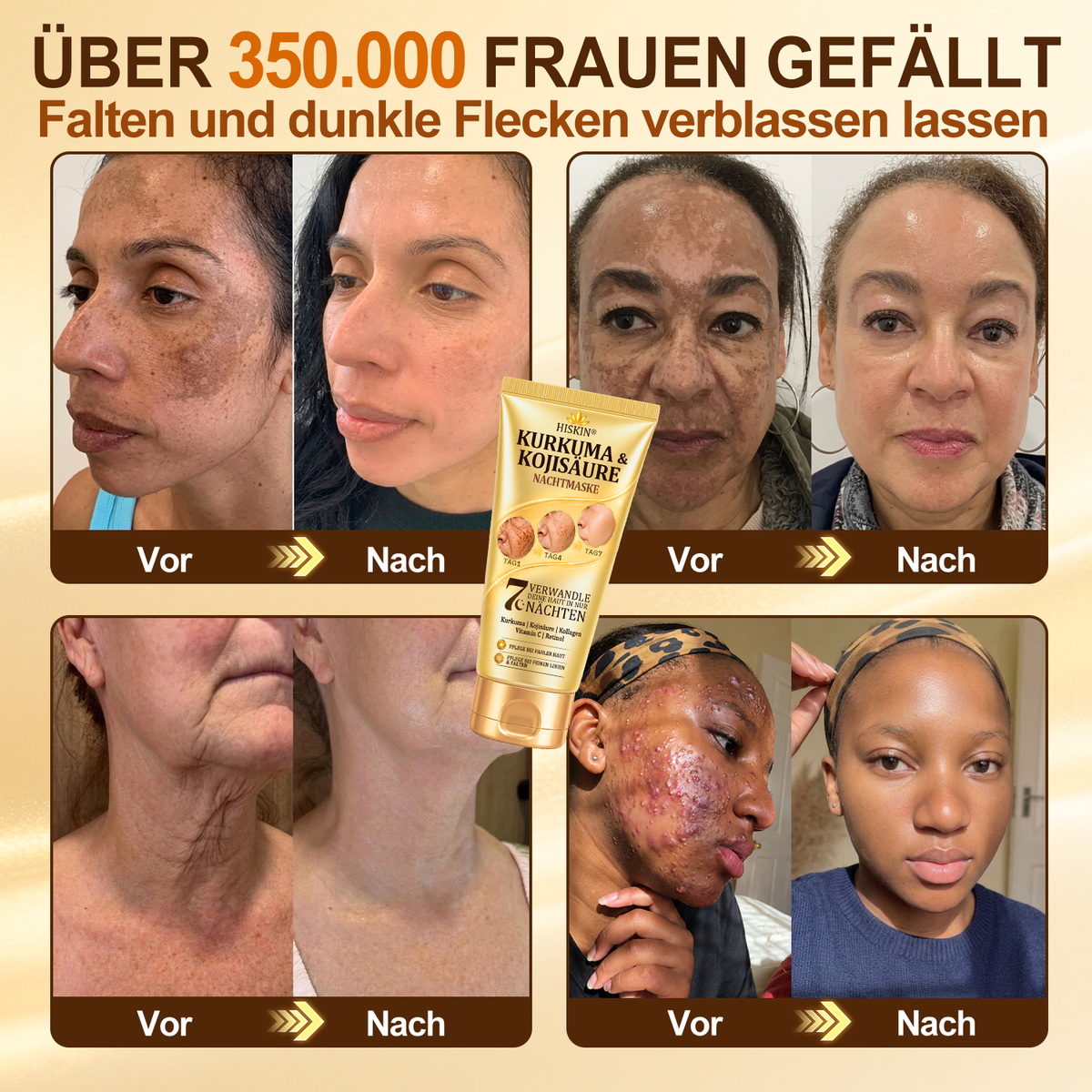 🚨 LETZTES ANGEBOT — Sichern Sie sich unseren niedrigsten Preis aller Zeiten: 90 % RABATT  Eine letzte Chance, 𝗛𝗜𝑺𝑲𝑰𝑵® mit unserem größten Rabattangebot zu sichern — dieses exklusive Angebot verschwindet, sobald Sie diese Seite verlassen.