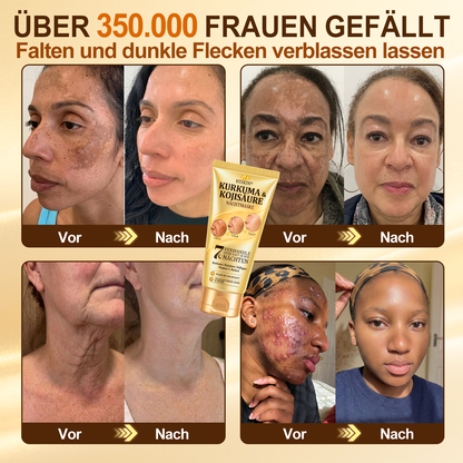 🚨 LETZTES ANGEBOT — Sichern Sie sich unseren niedrigsten Preis aller Zeiten: 90 % RABATT  Eine letzte Chance, 𝗛𝗜𝑺𝑲𝑰𝑵® mit unserem größten Rabattangebot zu sichern — dieses exklusive Angebot verschwindet, sobald Sie diese Seite verlassen.