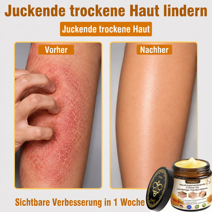 Letzte Chance! Sichern Sie sich diesen Glücksfund mit 90 % Rabatt, um Warzen dauerhaft zu entfernen! 🔥 180-Tage-Geld-zurück-Garantie! Handeln Sie schnell! HISKIN®