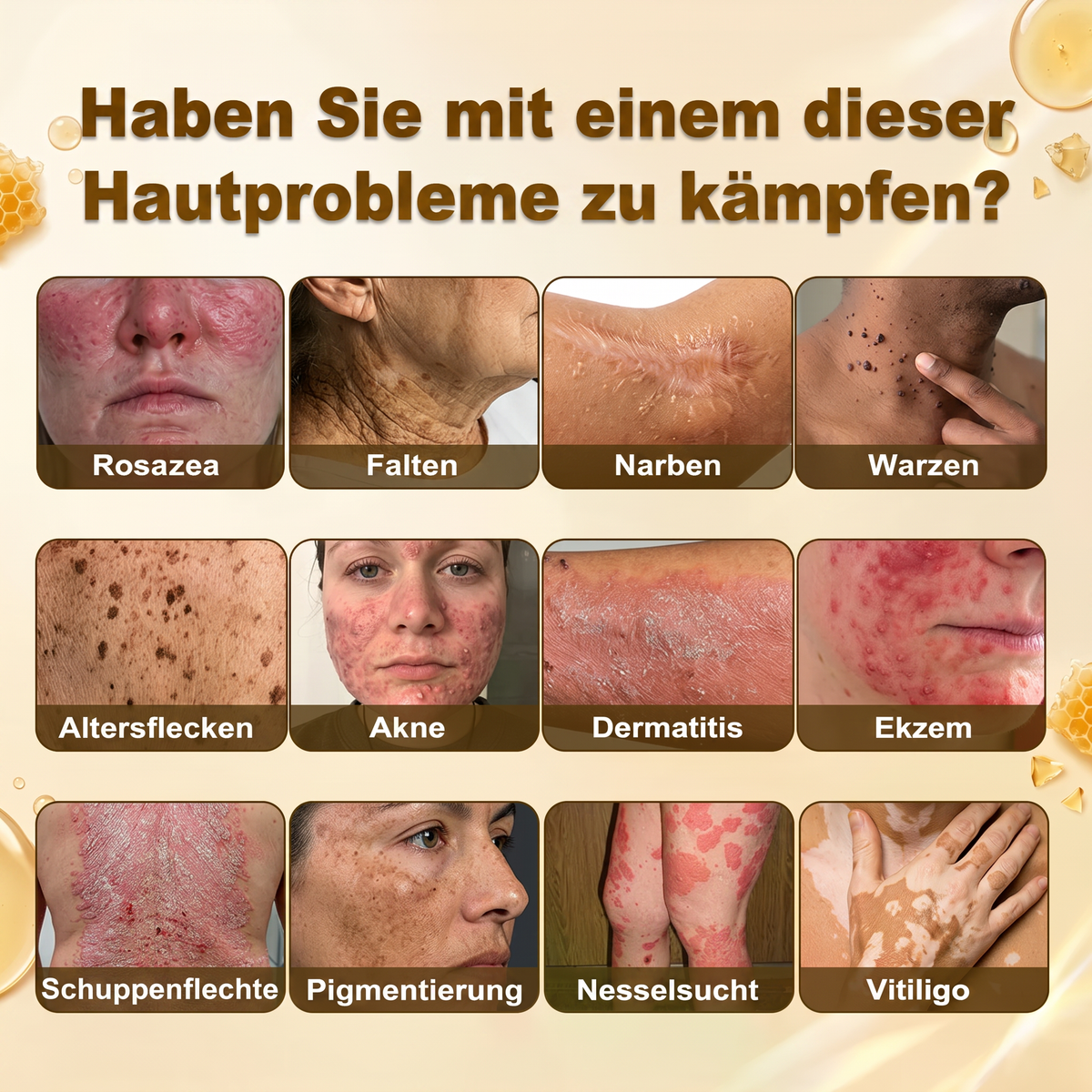 🚨 LETZTES ANGEBOT — Sichern Sie sich unseren niedrigsten Preis aller Zeiten: 90 % RABATT  Eine letzte Chance, 𝗛𝗜𝑺𝑲𝑰𝑵® mit unserem größten Rabattangebot zu sichern — dieses exklusive Angebot verschwindet, sobald Sie diese Seite verlassen.