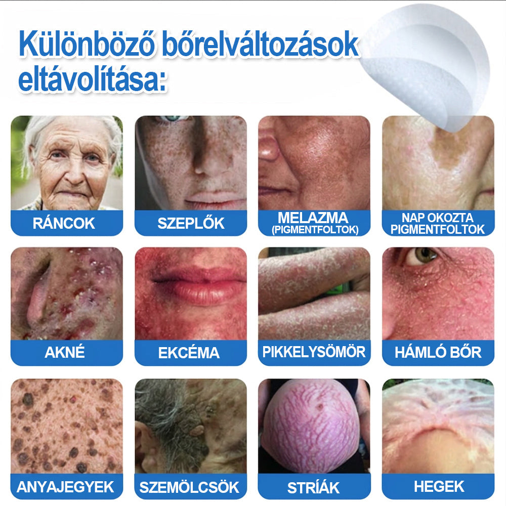 HISKIN® 2-in-1 Mikronadel- & Hydrokolloid-Pflaster | Entferner für erhabene Muttermale, Akne, flache Warzen & Hautanhängsel | Verbessert Falten, Narben & Hautunreinheiten | Unsichtbare Stern-Pickelpflaster für Gesicht & Körper