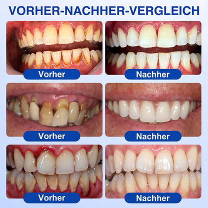 🇩🇪🏆🦷🛡️ Dr. Era® GumRevive — Klinisches Gel: Stoppt Zahnfleischbluten, regeniert Zahnfleisch & festigt Zähne
