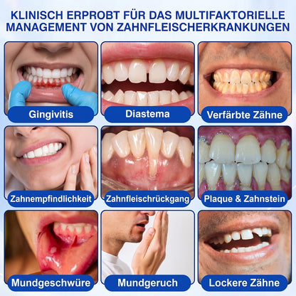 🇩🇪🏆🦷🛡️ Dr. Era® GumRevive — Klinisches Gel: Stoppt Zahnfleischbluten, regeniert Zahnfleisch & festigt Zähne