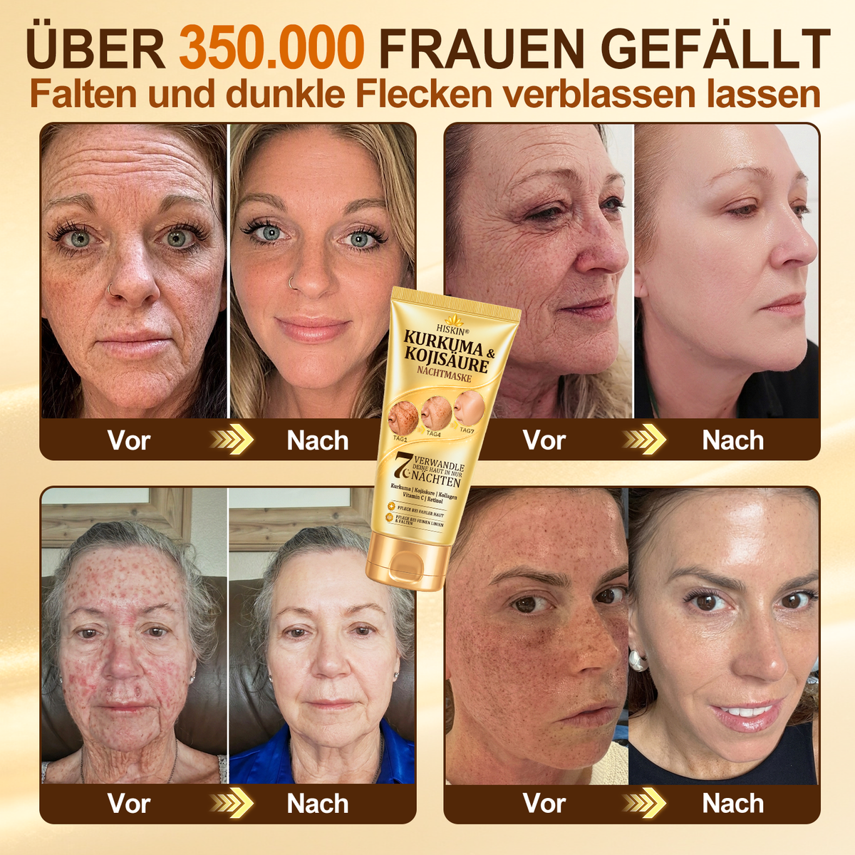 🚨 LETZTES ANGEBOT — Sichern Sie sich unseren niedrigsten Preis aller Zeiten: 90 % RABATT  Eine letzte Chance, 𝗛𝗜𝑺𝑲𝑰𝑵® mit unserem größten Rabattangebot zu sichern — dieses exklusive Angebot verschwindet, sobald Sie diese Seite verlassen.