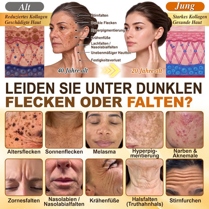 🚨 LETZTES ANGEBOT — Sichern Sie sich unseren niedrigsten Preis aller Zeiten: 90 % RABATT  Eine letzte Chance, 𝗛𝗜𝑺𝑲𝑰𝑵® mit unserem größten Rabattangebot zu sichern — dieses exklusive Angebot verschwindet, sobald Sie diese Seite verlassen.