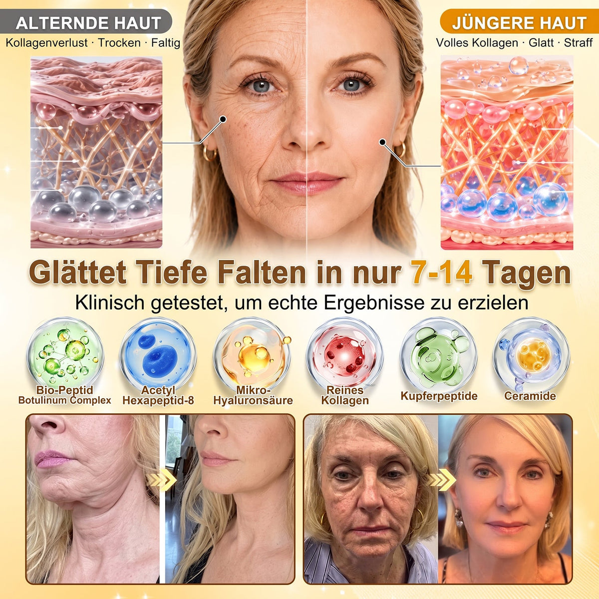 🚨 LETZTES ANGEBOT — Sichern Sie sich unseren niedrigsten Preis aller Zeiten: 90 % RABATT  Eine letzte Chance, 𝗛𝗜𝑺𝑲𝑰𝑵® mit unserem größten Rabattangebot zu sichern — dieses exklusive Angebot verschwindet, sobald Sie diese Seite verlassen.