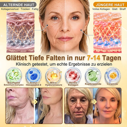 🚨 LETZTES ANGEBOT — Sichern Sie sich unseren niedrigsten Preis aller Zeiten: 90 % RABATT  Eine letzte Chance, 𝗛𝗜𝑺𝑲𝑰𝑵® mit unserem größten Rabattangebot zu sichern — dieses exklusive Angebot verschwindet, sobald Sie diese Seite verlassen.