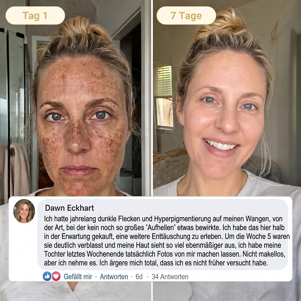 🚨 LETZTES ANGEBOT — Sichern Sie sich unseren niedrigsten Preis aller Zeiten: 90 % RABATT  Eine letzte Chance, 𝗛𝗜𝑺𝑲𝑰𝑵® mit unserem größten Rabattangebot zu sichern — dieses exklusive Angebot verschwindet, sobald Sie diese Seite verlassen.
